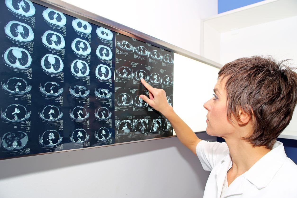When Might a Lung Biopsy be Necessary?-TTLIFE OXYGEN CONCENTRATOR