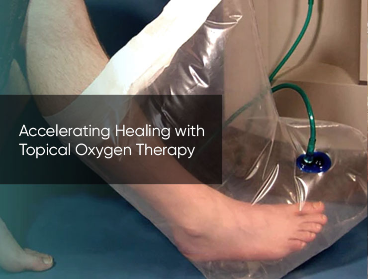 Accelerating Healing with Topical Oxygen Therapy