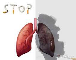 TTLIFE Oxygen Concentrator — What should long-term smokers eat?