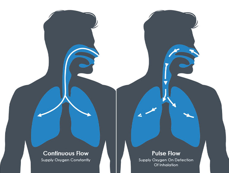 Choosing the Right Oxygen Flow: Pulse or Continuous?